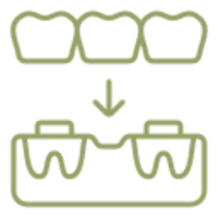 custom crowns and bridges