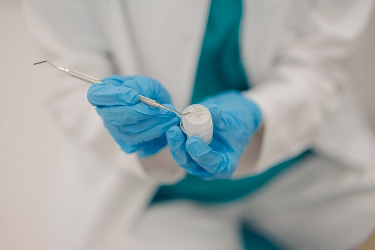 Dental Fillings in NE Calgary