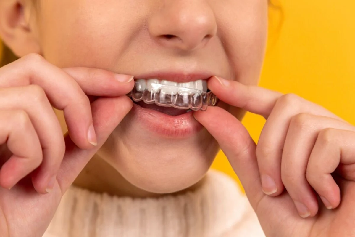 How Much Does Invisalign Cost and Does Insurance Cover It?